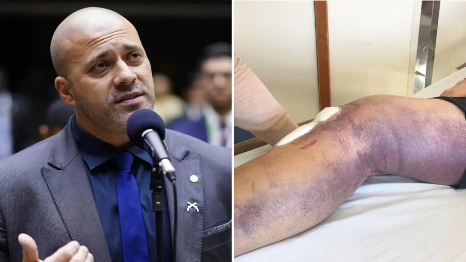 PGR apoia saída temporária de Daniel Silveira para tratamento pós-cirúrgico - Imagem do artigo original